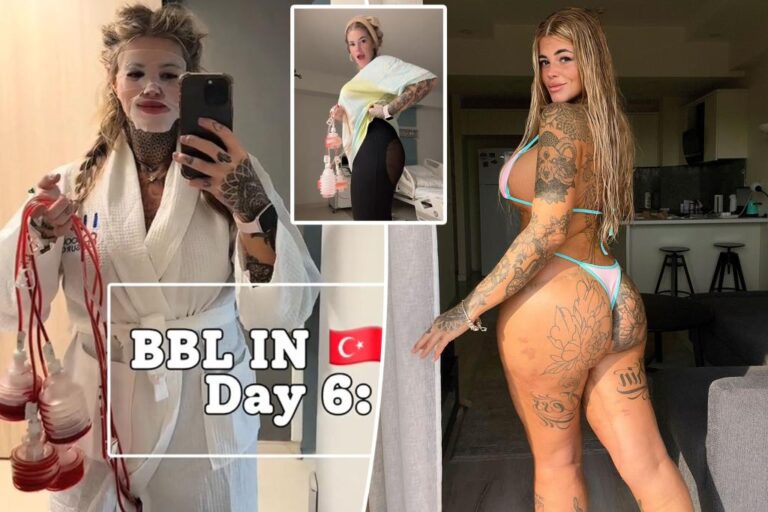 I'm on my second BBL after the first one 'died' - having a perfect body is worth the risk

