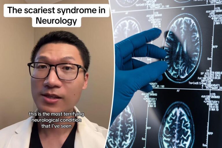 I'm a neurologist - the scariest condition I've ever seen, and I've seen a lot

